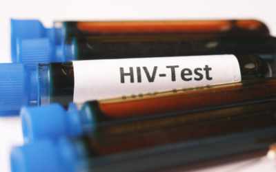provette di sangue con tappo blu, una di queste ha un'etichetta con scritto HIV-Test