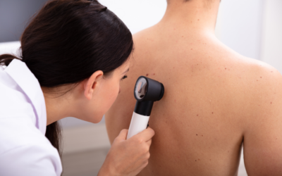 dermatologa controlla la schiena di un paziente con lente di ingrandimento